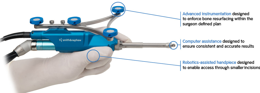 robotic knee replacement surgeon